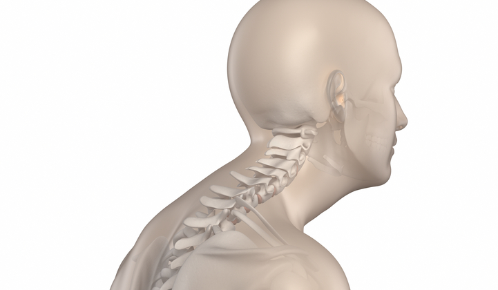 kyphosis posture